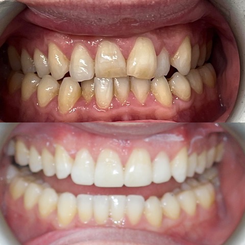 Dental Implants Southport