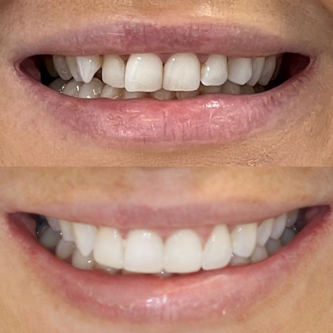 Dental Implants Southport