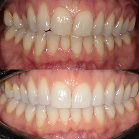 Dental Implants Southport